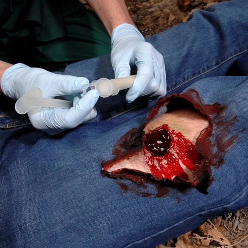 Аппликатор гемостатический с гранулами Rhino Rescue в Курске хитозановый